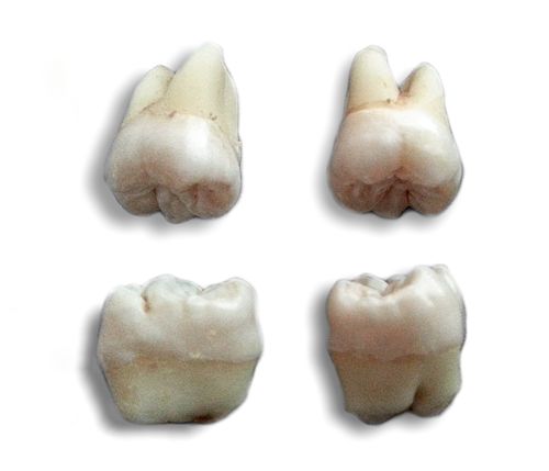 Wisdom Teeth